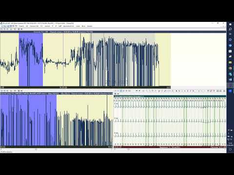 Видео: Майстер клас ECGpro Holter 22.06.2023