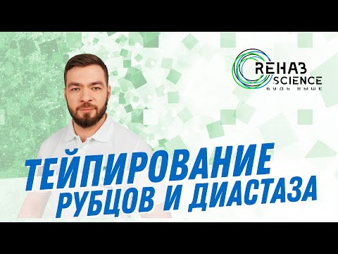 Видео: Тейпирование рубцов и диастаза. Кинезиотейпирование рубца и диастаза.