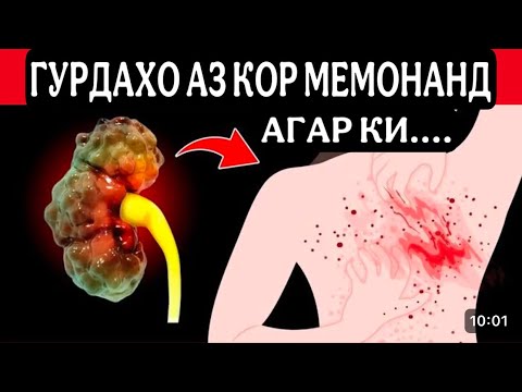 Видео: Аломатхои хатарноке, ки аз норасогии гурдахо хабар медиханд!