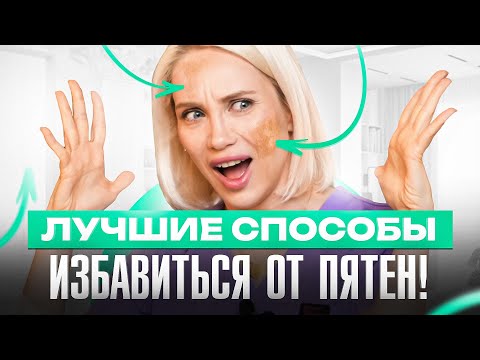 Видео: Как избавиться от пигментных пятен — 6 лучших способов