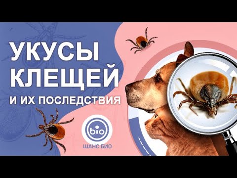 Видео: Укусы клещей и их последствия