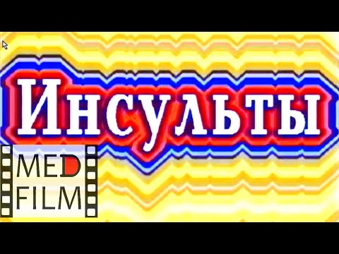 Видео: Инсульты, инфаркт мозга, кровоизлияние, тромб сосудов мозга © Strokes