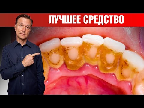 Видео: Зубной налет и зубной камень? Лучшее средство! Сделайте сами🙌