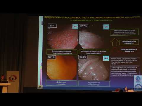 Видео: 02 Пирогов СС Инфекция H Pylori Взгляд эндоскописта