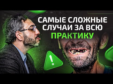 Видео: Самый сложный случай в практике разных стоматологов