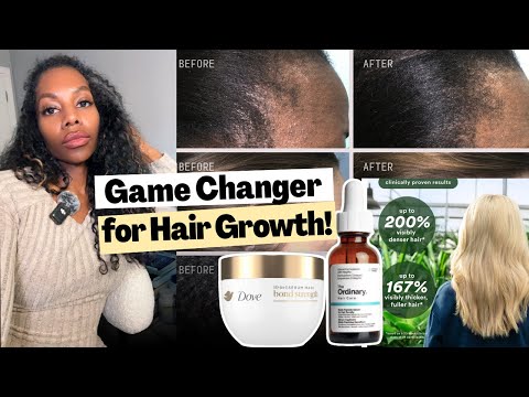 Видео: Если у вас выпадают волосы... вам нужны пептиды! Это не подлежит обсуждению! Вот почему...