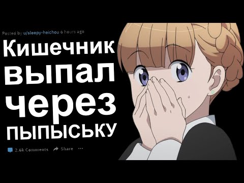 Видео: ВРАЧИ РЕДДИТ О САМОМ ТУПОМ ПАЦИЕНТЕ