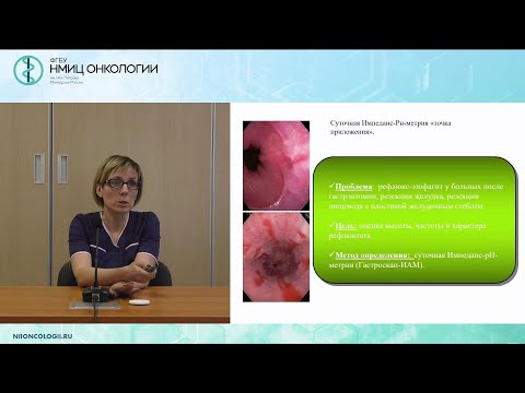 Видео: Захарова П.А. Гастроэнтеролог и онкологический пациент: справляемся с осложнениями после терапии