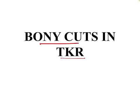 Видео: Костные разрезы при тотальном эндопротезировании коленного сустава