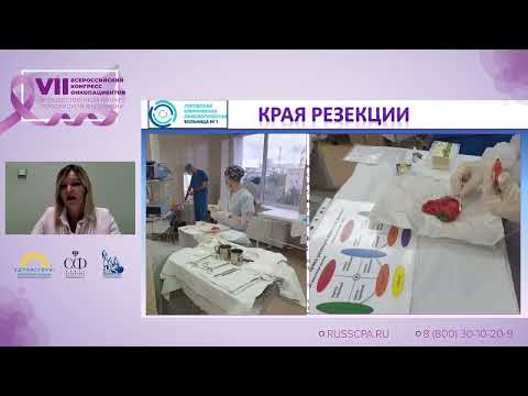 Видео: Ермощенкова М.В. | Возможности онкопластической хирургии в современной онкомаммологии