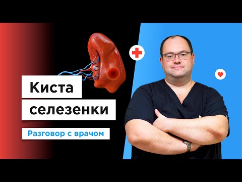 Видео: Что нужно знать о кисте селезенки? Рассказывает врач