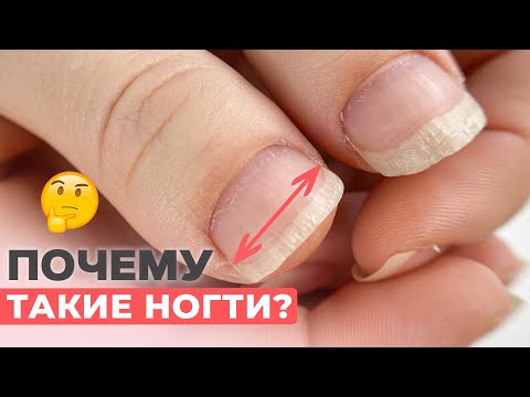 Видео: Как исправить такие широкие ногти? | Укрепление ногтей гелем