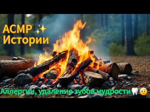 Видео: АСМР болталка | Мои новые аллергии, об удалениях зубах мудрости | иголочки и царапанье ветрозащиты |