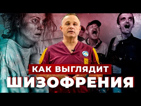 Видео: ШИЗОФРЕНИЯ: причины, симптомы, признаки | Лечение шизофрении | Как выглядит шизофрения?
