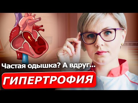 Видео: ГИПЕРТРОФИЯ ЛЕВОГО ЖЕЛУДОЧКА | Поговорим о сердце