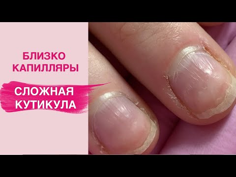 Видео: Сложная кутикула | Боязнь каждого мастера маникюра