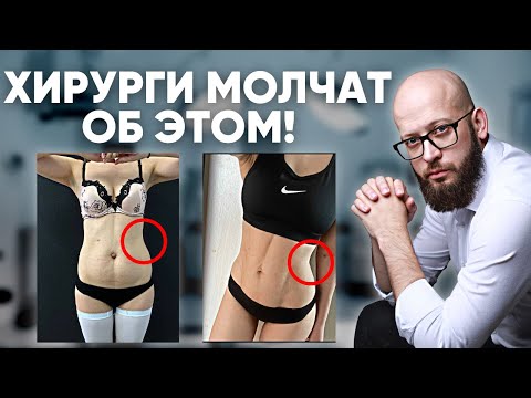 Видео: Что такое липосакция? Сколько стоит липосакция 2022? Виды липосакций. О чем молчат хирурги?