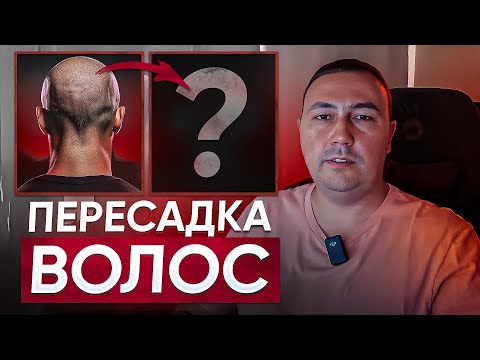 Видео: Что происходит через 2 года после Пересадки Волос? Мой опыт и Честный отзыв о Клинике R.T.H.