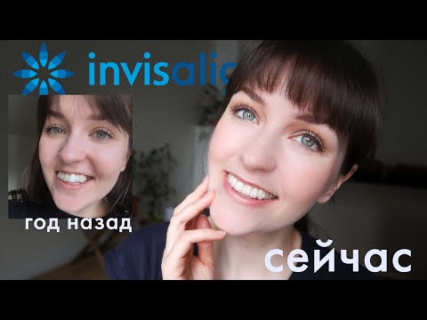 Видео: ЭЛАЙНЕРЫ | ГОД СПУСТЯ | РЕЗУЛЬТАТЫ, БОЛЬ, ВАШИ ВОПРОСЫ 😬