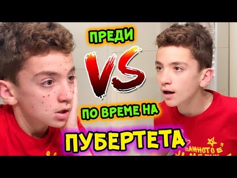 Видео: ПУБЕРТЕТЪТ: ПРЕДИ И ПО ВРЕМЕ | СКЕЧОВЕ