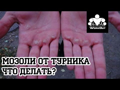 Видео: Мозоли от турника. Что делать? | Антон Кучумов | SOTKA - День 23