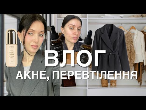 Видео: ДОМАШНІЙ ВЛОГ: ПРОДОВЖЕННЯ РОЗХЛАМЛЕННЯ, АКНЕ НА ГВ, НОВА Я 