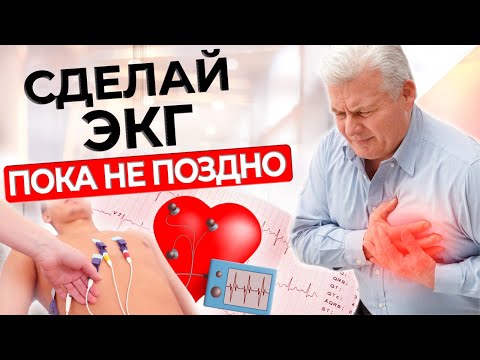 Видео: ЭКГ | Кому нужно пройти диагностику