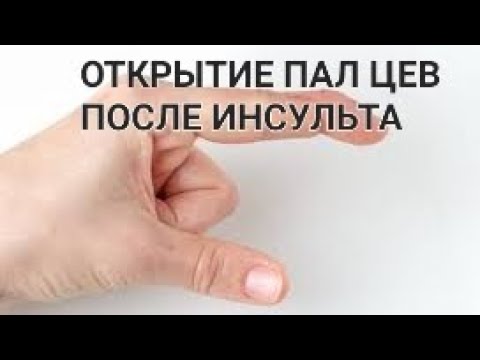 Видео: КАК ОТКРЫТЬ ПАЛЬЦЫ ПОСЛЕ ИНСУЛЬТА 