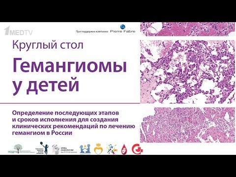 Видео: Определение последующих этапов и сроков исполнения для создания клинических рекомендаций