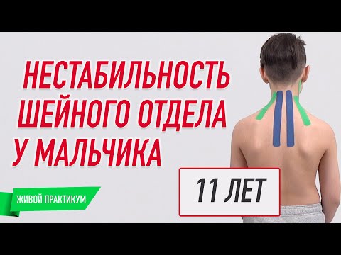 Видео: ✅ ЖИВОЙ ПРИЕМ  НЕСТАБИЛЬНОСТЬ ШЕЙНОГО ОТДЕЛА У МАЛЬЧИКА / 11 лет / Валентин Гайт | BBALANCE