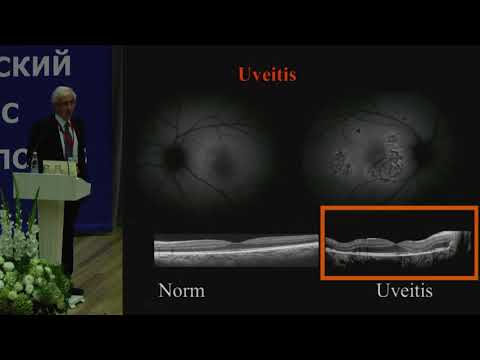 Видео: Л.Б. Марголис, США, Экстраклеточные везикулы: новые игроки в патофизиологии человека