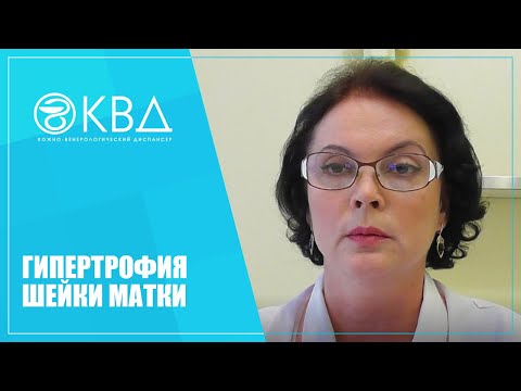 Видео: 1133  Гипертрофия шейки матки