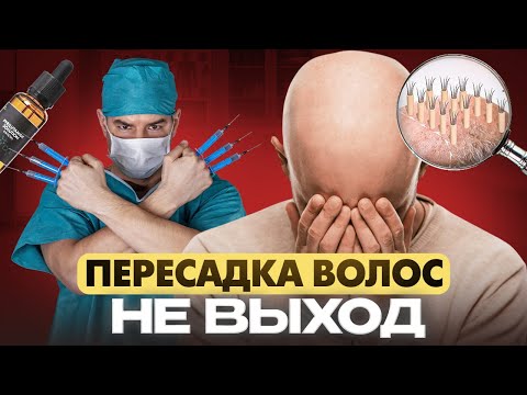 Видео: Когда НУЖНО делать пересадку волос? 3 случая, когда без неё не обойтись
