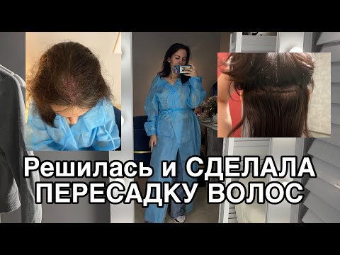 Видео: Андрогенная алопеция | СДЕЛАЛА ПЕРЕСАДКУ