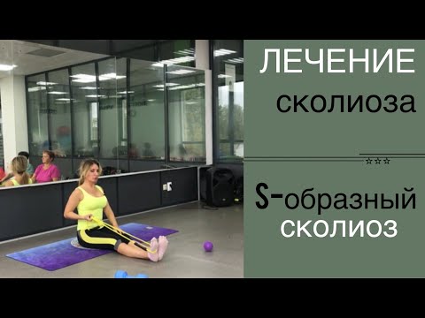 Видео: Лечение сколиоза. s-образный сколиоз. Часть 2