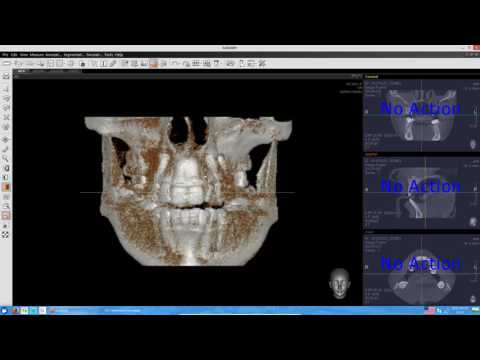 Видео: EZ3D2009 (просмотр КТ) - инструкция пользователя