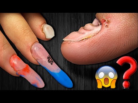 Видео: 😱 ПЗДЦ на Ногтях.❌ НОГТИ В 13 Лет?! НОВИНКА! САМОЕ Прочное НАРАЩИВАНИЕ ногтей.ТРЕШ МАНИКЮР.GEL NAILS