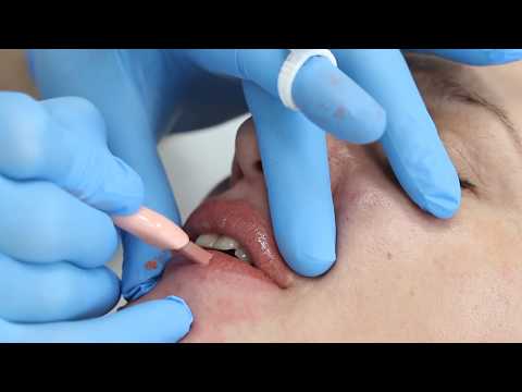 Видео: Мануальная технология SofTap. Татуаж губ.