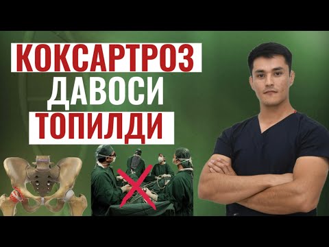 Видео: КОКСАРТРОЗ ДАВОСИ ТОПИЛДИ