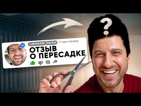 Видео: АМИРАН САРДАРОВ. ВСЯ ПРАВДА ПРО ПЕРЕСАДКУ ВОЛОС
