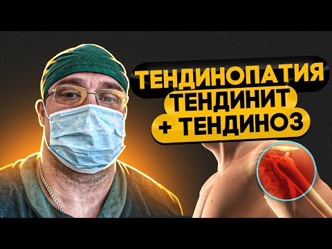 Видео: ТЕНДИНОПАТИЯ | Тендинит | Тендиноз | КАК ЭТО ЛЕЧИТЬ? Доктор Юршин