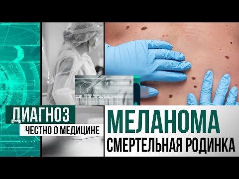 Видео: Прожить ещё месяц: как казахстанские пациенты с меланомой борются за жизнь | Диагноз