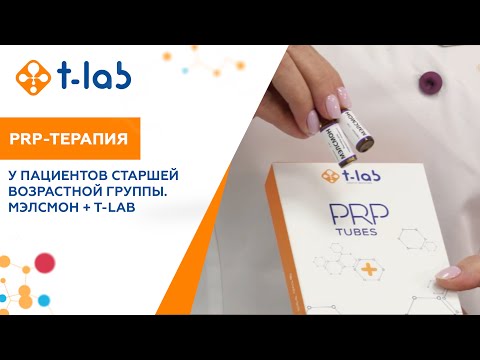 Видео: PRP-терапия у пациентов старшей возрастной группы. Мэлсмон + T-Lab