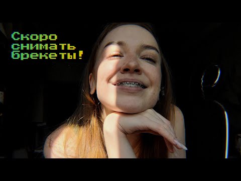 Видео: Болтаем! Спустя 3 года лечения - скоро снимать брекеты!