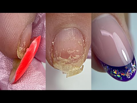 Видео: Ужасная отслойка на весь ноготь😱Выкладной френч на натуральных ногтях💅Маникюр на клиенте
