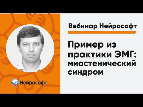 Видео: Пример из практики ЭМГ: миастенический синдром | Вебинар Нейрософт