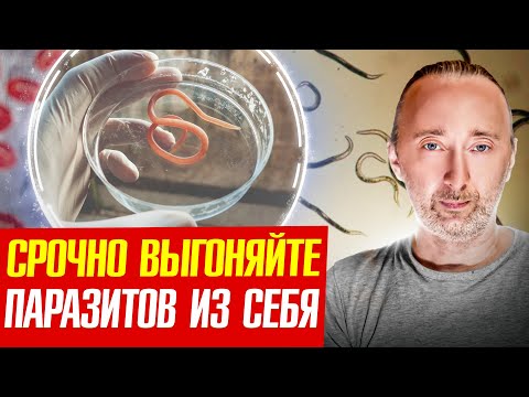 Видео: ГЛИСТЫ: Только так можно убрать всех паразитов из организма!