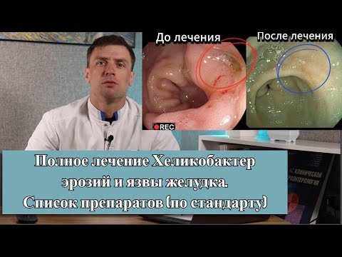 Видео: Лечим Хр. Язву желудка, эрозии и хеликобактер! За один раз и на долго. Видео До и После лечения.
