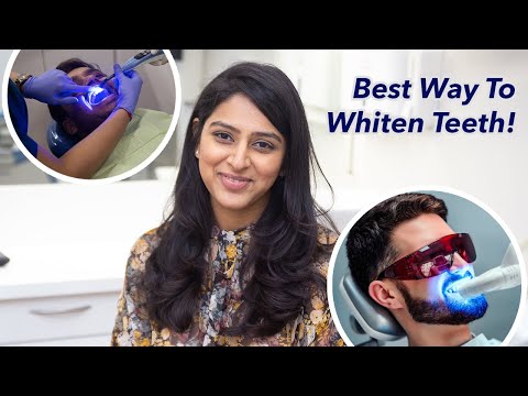 Видео: Самый быстрый способ отбелить зубы: объясняет стоматолог. Полезно ли отбеливание зубов?