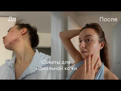 Видео: Моя история акне и советы по уходу *СМОТРЕТЬ ВСЕМ*